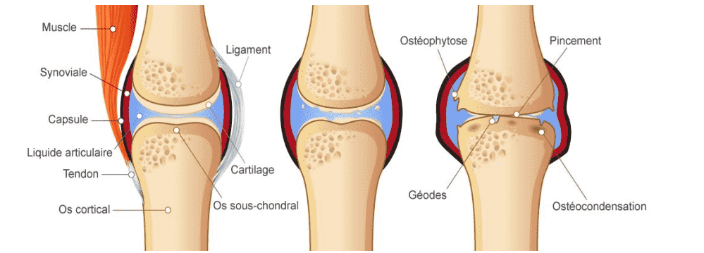 Illustration d'une articulation