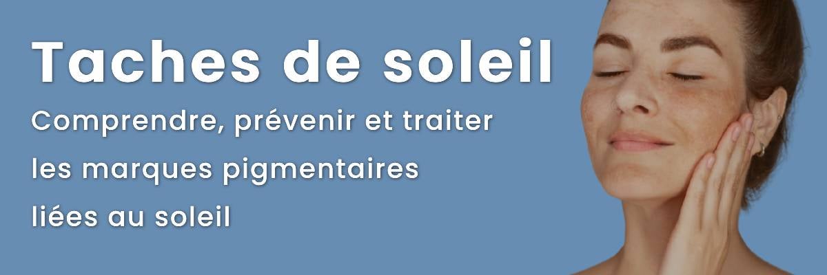 Taches de soleil : comprendre, prévenir et traiter les marques pigmentaires liées au soleil