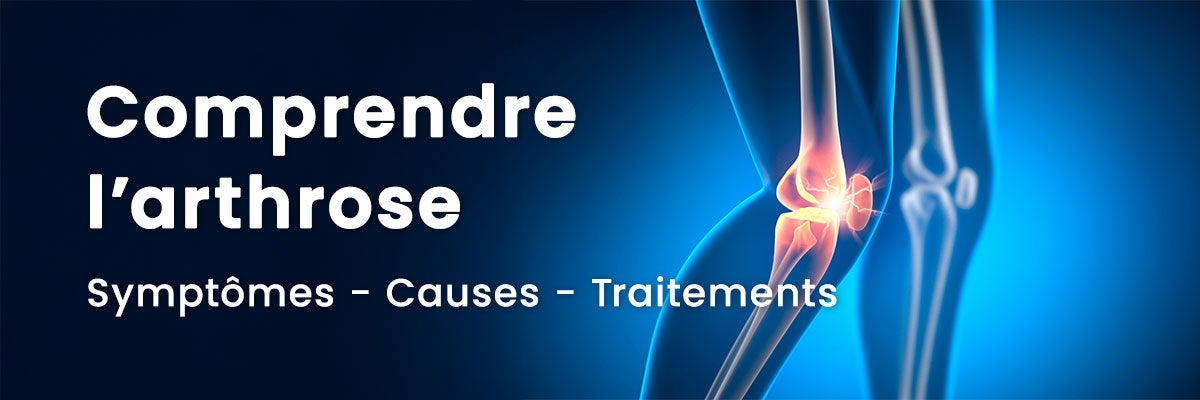Comprendre l&rsquo;arthrose : symptômes, causes et traitements