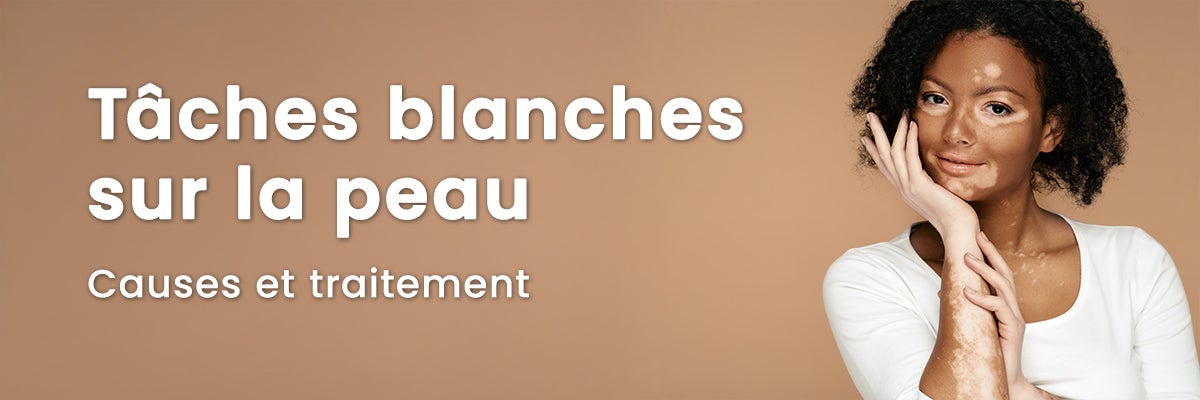 Tache blanche sur la peau : comprendre les causes et solutions
