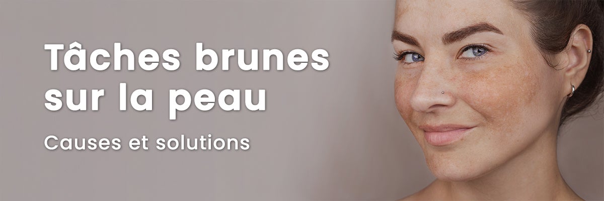 Tache brune sur la peau : comprendre, prévenir et gérer efficacement