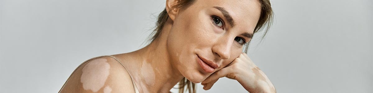 Diff&eacute;rentes causes taches sur la peau