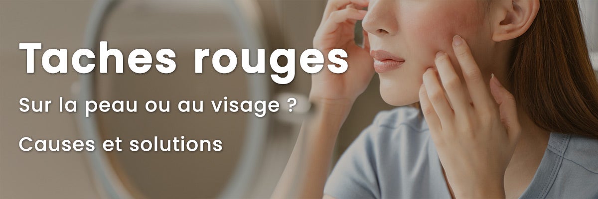 Taches rouges au visage ? Origine des rougeurs et solutions efficaces