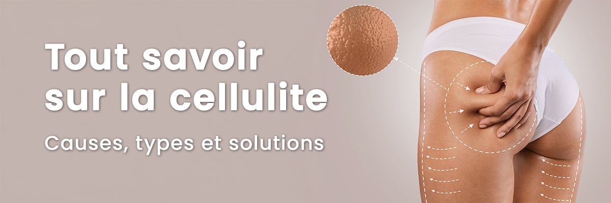Tout savoir sur la cellulite : types, causes et solutions