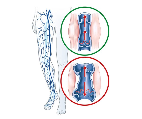 Sch&eacute;ma fonctionnement veines
